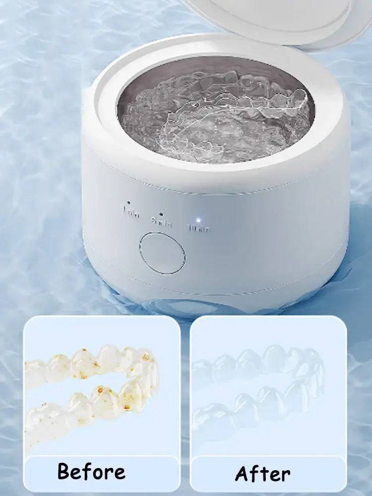 New Electric Braces Box Cleaning Box Multi-function Invisible Retainer Denture Cleaning Machine Jewelry Orthodontic Cleaner |  | Luvasmr - Satisfyingly Organised